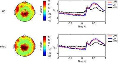 Variation of Functional Neurological Symptoms and Emotion Regulation with Time